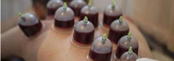 拔罐出水泡怎么回事