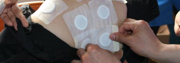 三伏贴真的有用吗