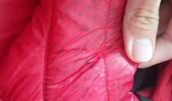 衣服发黑霉怎么办