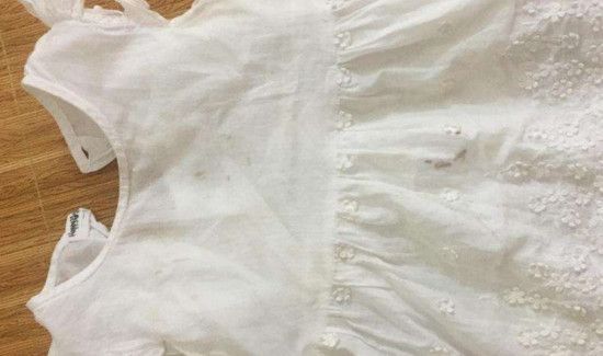 衣服发黑霉怎么办