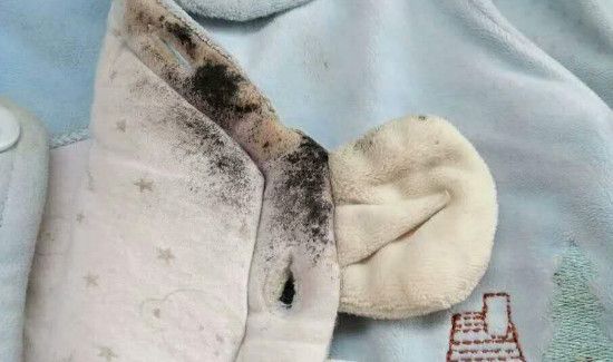 长霉点的衣服怎么洗