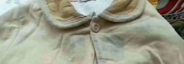 长霉点的衣服怎么洗