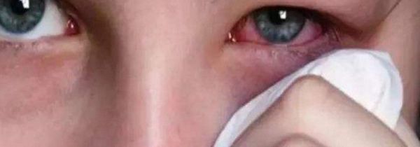 隐形眼镜带反了会怎样