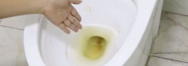 便池里的黄渍怎么去除