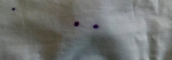 白色衣服上的墨水怎么洗掉