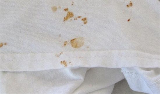 白衣服上的铁锈怎么去除小窍门