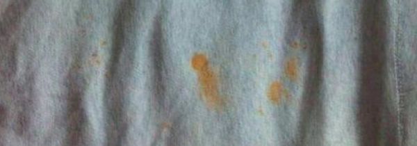 白衣服上的铁锈怎么去除小窍门