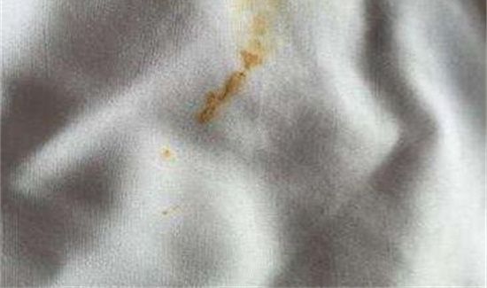 白衣服上的铁锈怎么去除小窍门