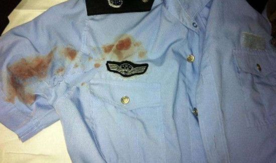 如何去除衣服上油味