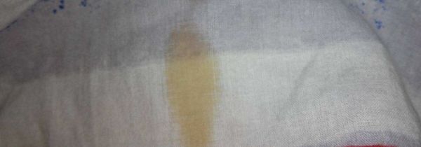 衣服上油点用洗洁精可以去除吗?