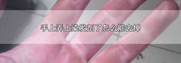 手上弄上染发剂了怎么能去掉