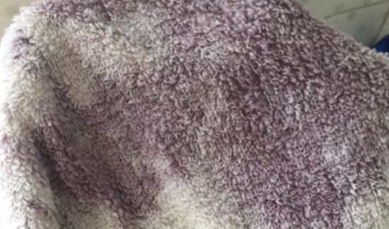 毛巾为何会变成紫色