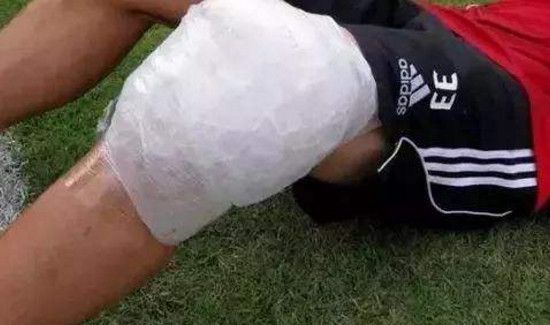 冰块可以消肿化瘀吗