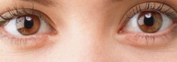 美瞳带反了什么感觉