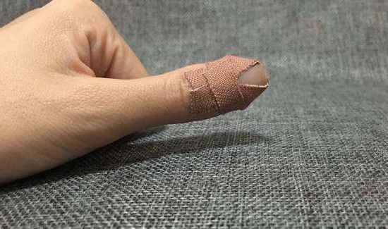 去除创可贴胶印小窍门