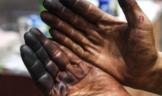 吃核桃手黑怎么洗掉