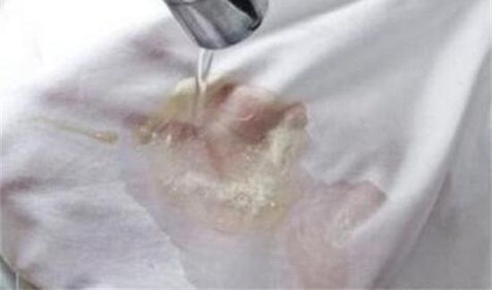 衣服上蜡烛油用风油精