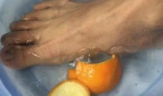 橘皮水泡脚的作用