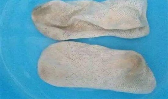 白袜子发黄怎么洗白