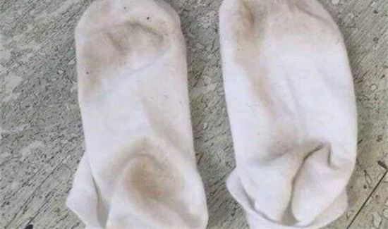 白袜子发黄怎么洗白