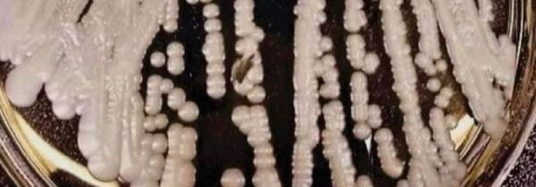 消毒液能杀死真菌吗