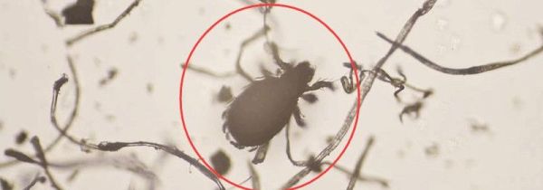 香叶可以去螨虫吗