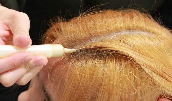 漂发后怎么恢复黑色