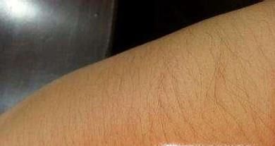 怎样可以使汗毛变淡