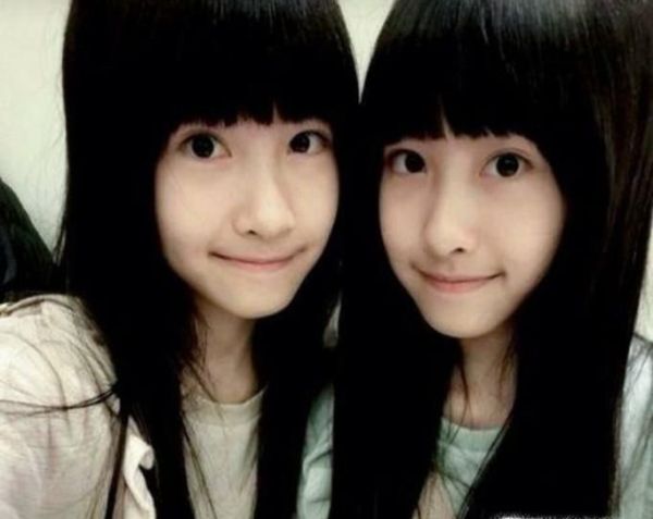 为什么双胞胎外貌都非常相似