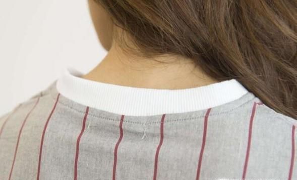 冬季头发静电怎么办