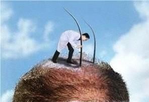 4个小妙招教你摆脱大额头