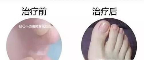 风油精可以吃吗?风油精有哪些功效?