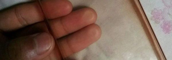 清洁手机壳的方法