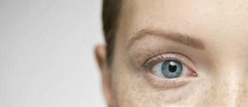 雀斑是怎样形成的