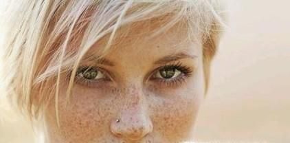 雀斑是怎样形成的