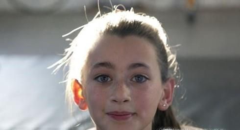 雀斑是怎样形成的