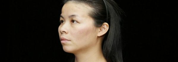 去除鼻唇沟的锻炼方法