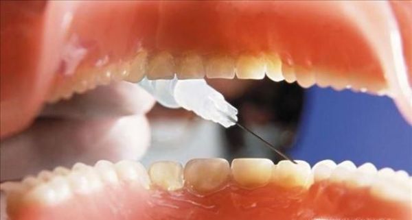 不刷牙给我们带来的坏处