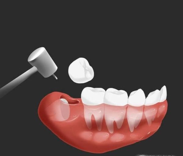 不刷牙给我们带来的坏处