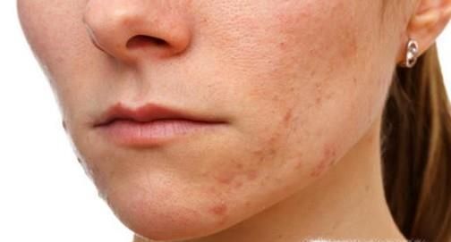 热姜水有哪些意想不到的作用呢？