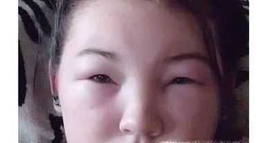 长期化妆容易有哪些健康隐患?