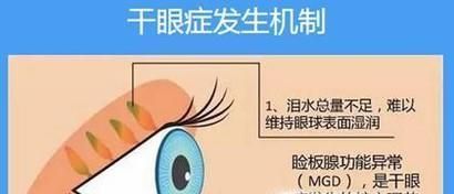 熬夜玩手机对眼睛的危害