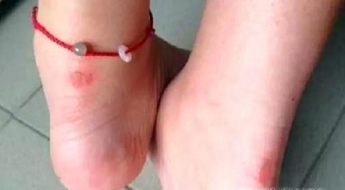 怎样将护唇膏用在生活中其他方面？