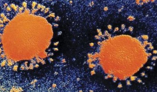 肺炎属于什么病毒