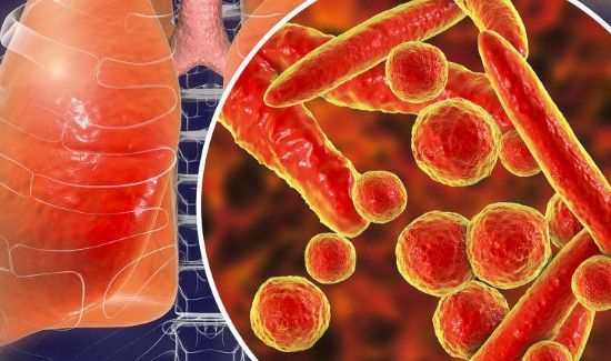 肺炎属于不可抗力吗