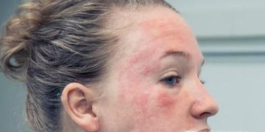 如何挑选芒果？吃芒果有哪些禁忌？