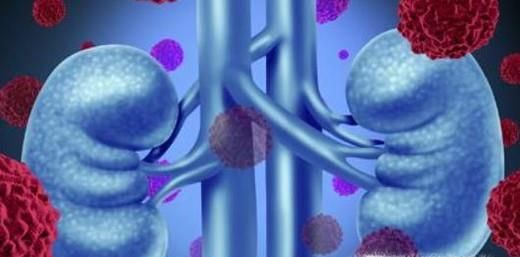 如何挑选芒果？吃芒果有哪些禁忌？