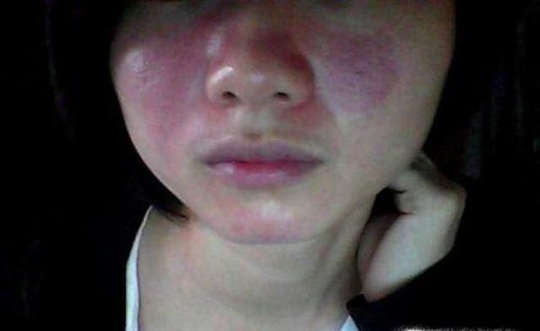 怎样检测护肤品重金属含量