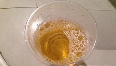 童子尿可以直接喝吗