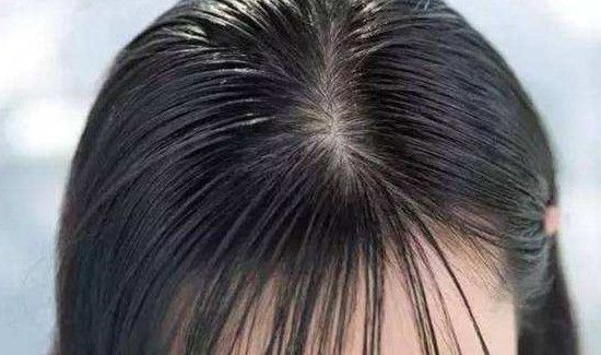 怎么让头发变多